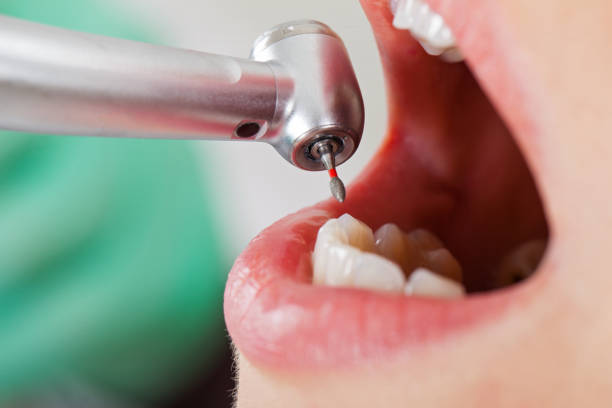 Best Dentist for Tooth Abscess  in Marshfield, WI